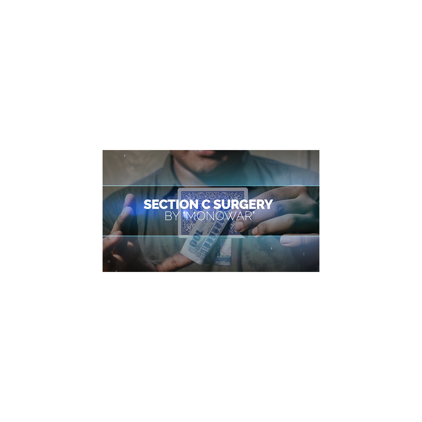 Section C Surgery by Monowar video DOWNLOAD
