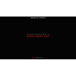 CARDIOGRAPHIC RRP by Martin Lewis